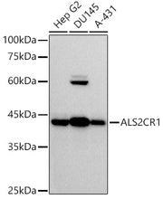 ALS2CR1 Rabbit mAb