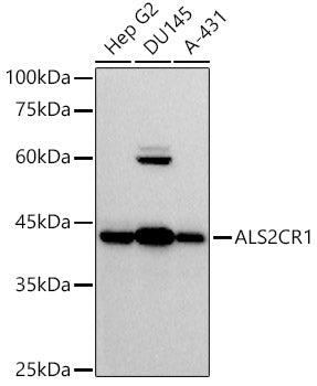 ALS2CR1 Rabbit mAb