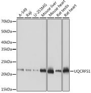 UQCRFS1 Rabbit mAb