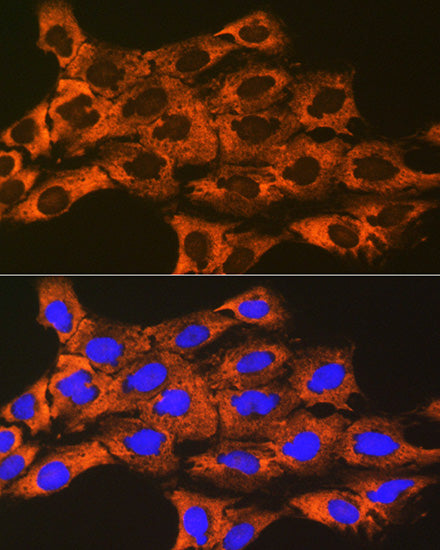 UQCRFS1 Rabbit mAb