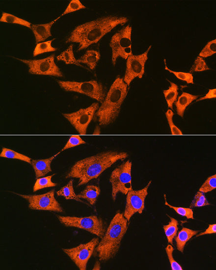 UQCRFS1 Rabbit mAb