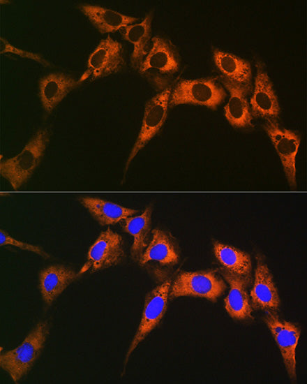 UQCRFS1 Rabbit mAb
