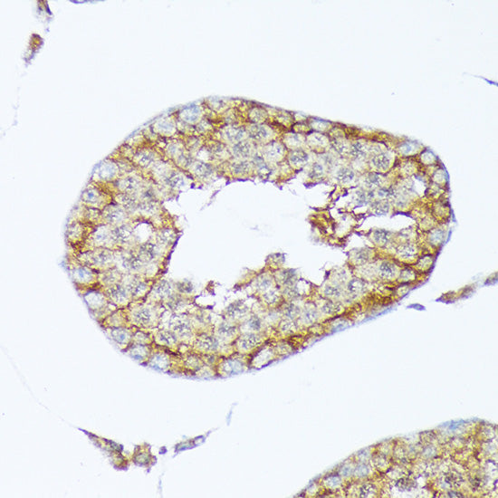 Cortactin Rabbit mAb