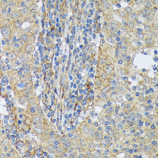 Cortactin Rabbit mAb