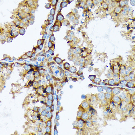 Cortactin Rabbit mAb