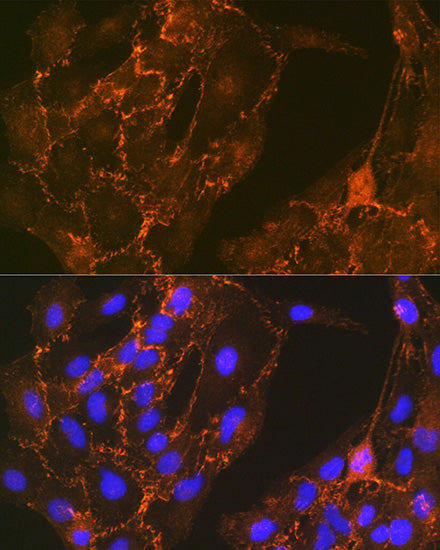 Cortactin Rabbit mAb