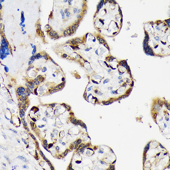 LIN28B Rabbit mAb