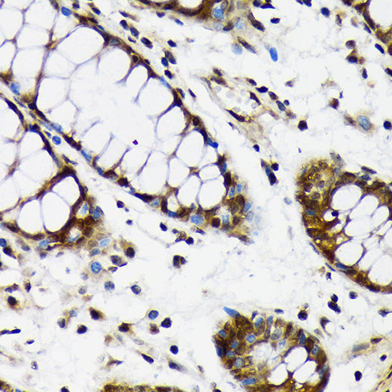 CDC5L Rabbit mAb