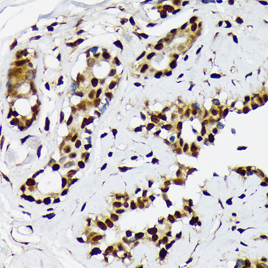 ILF2 Rabbit mAb