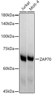 ZAP70 Rabbit mAb