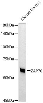 ZAP70 Rabbit mAb