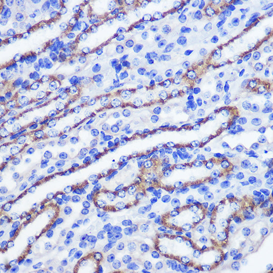 PHLPP1 Rabbit pAb