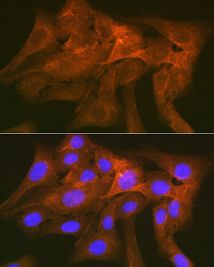 CD172a/SIRPα Rabbit mAb