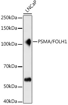 PSMA/FOLH1 Rabbit mAb