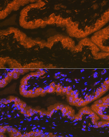 PSMA/FOLH1 Rabbit mAb