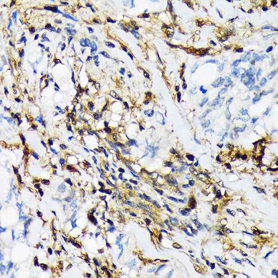 PSMB9/LMP2 Rabbit mAb