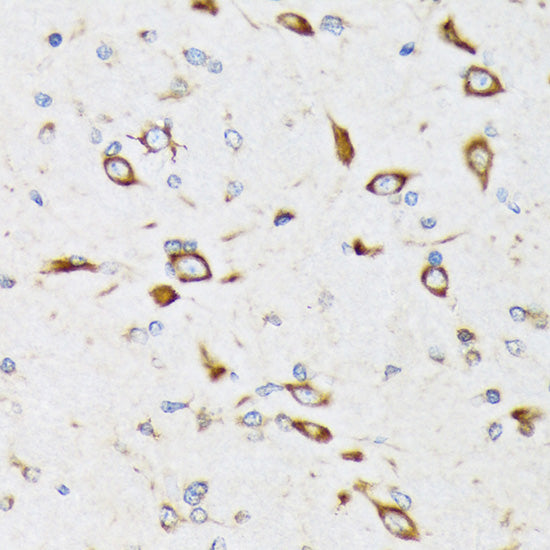 RPS20 Rabbit mAb