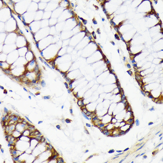 RPS20 Rabbit mAb