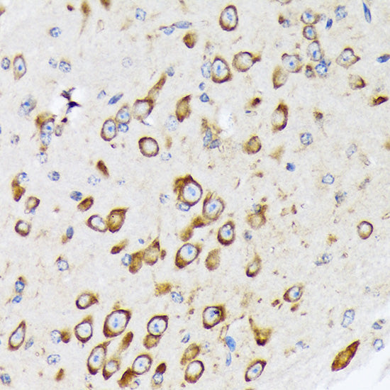 RPS20 Rabbit mAb