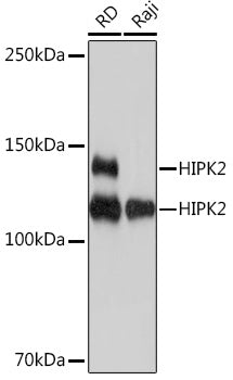 HIPK2 Rabbit mAb