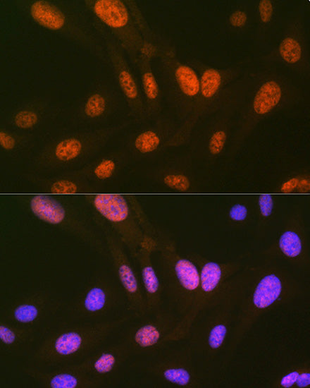 HIPK2 Rabbit mAb