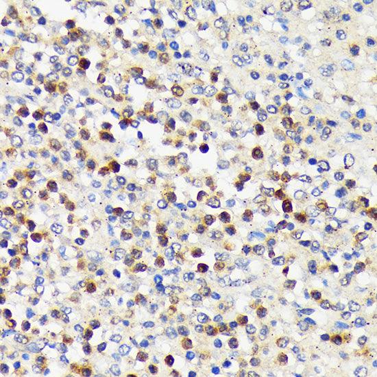 CD5 Rabbit mAb