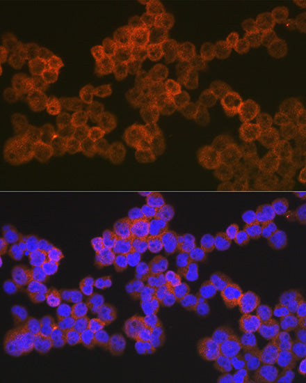 CD5 Rabbit mAb
