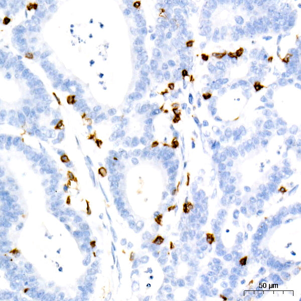 CD7 Rabbit mAb