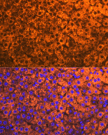 CYP2D6 Rabbit mAb