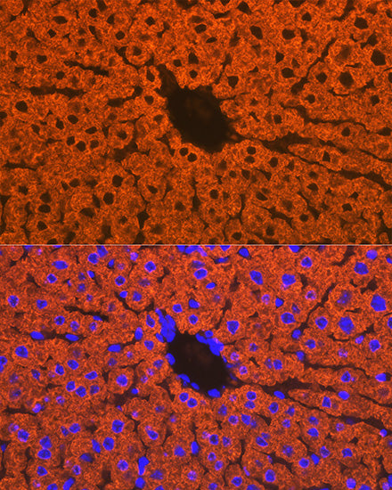 CYP2D6 Rabbit mAb