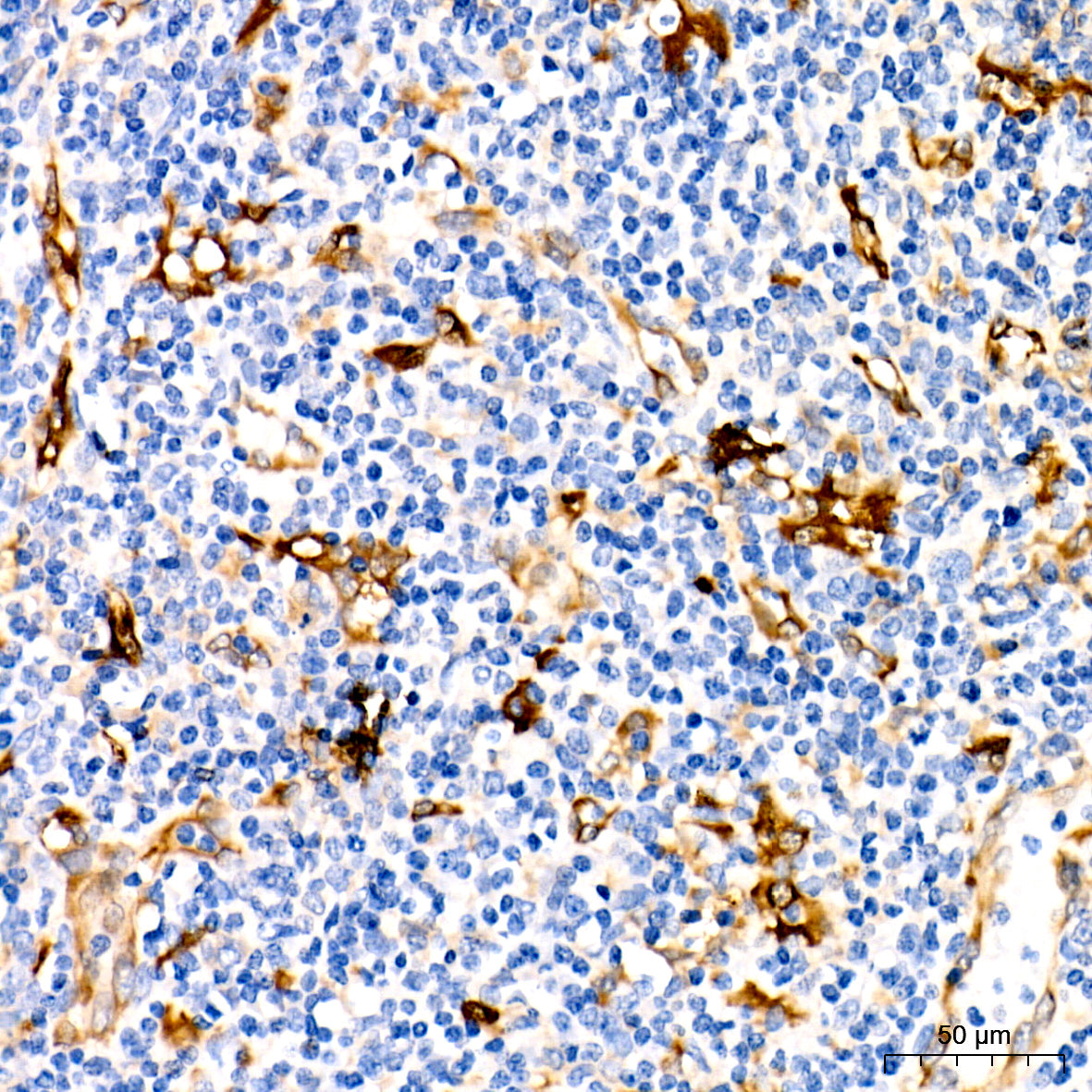 Fascin/FSCN1 Rabbit mAb