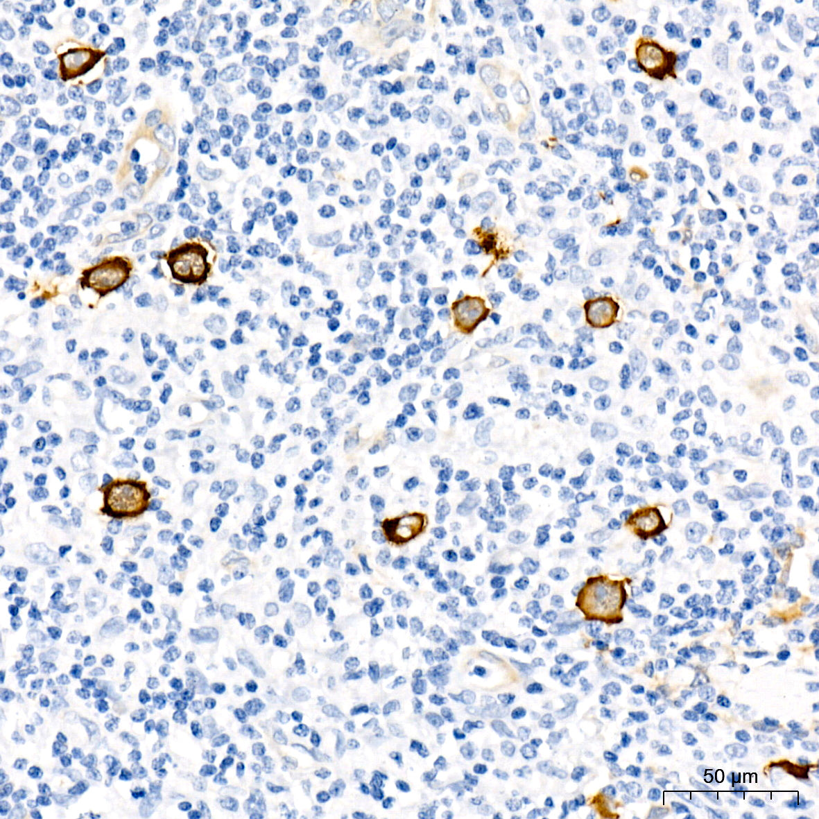 Fascin/FSCN1 Rabbit mAb