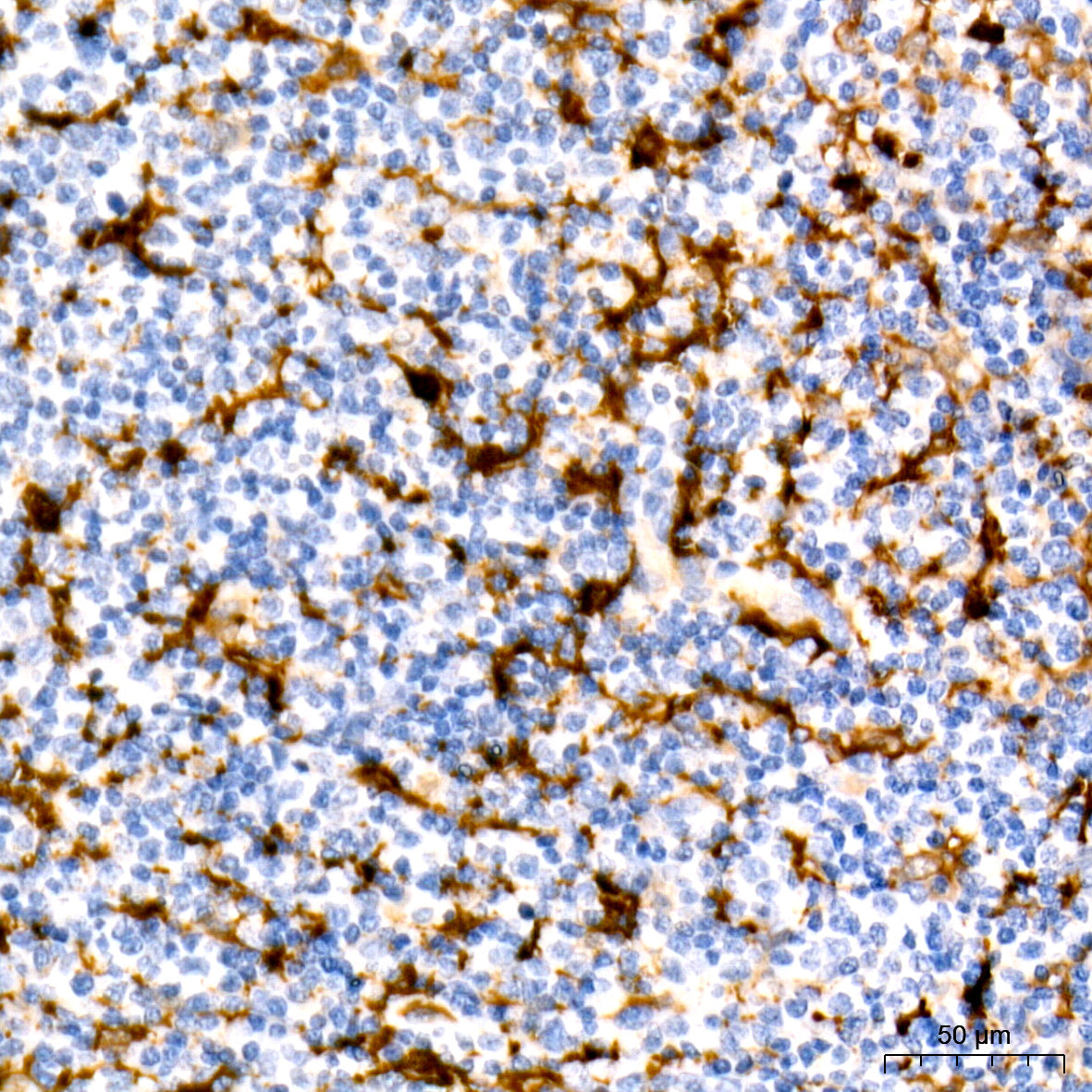 Fascin/FSCN1 Rabbit mAb