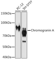 Chromogranin A Rabbit mAb