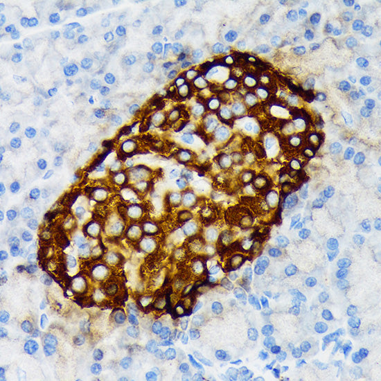 Chromogranin A Rabbit mAb