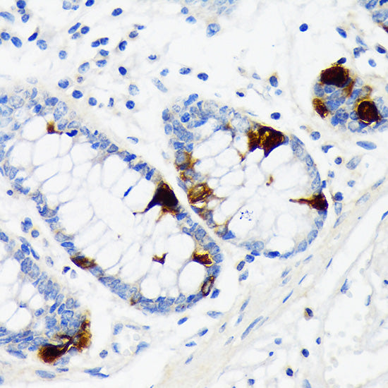 Chromogranin A Rabbit mAb
