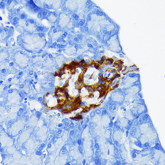 Chromogranin A Rabbit mAb