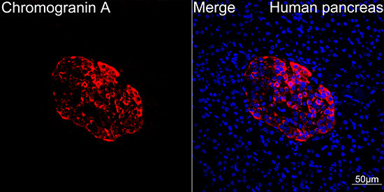 Chromogranin A Rabbit mAb