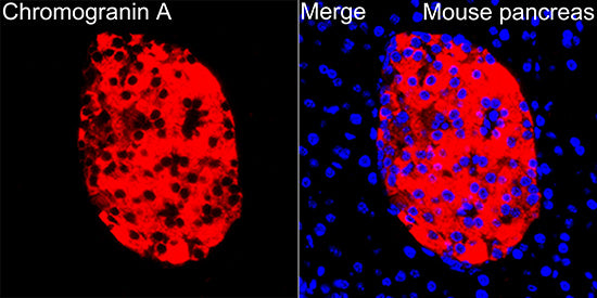 Chromogranin A Rabbit mAb