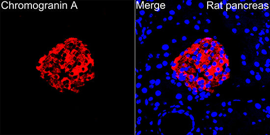 Chromogranin A Rabbit mAb