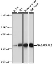 GABARAPL2 Rabbit mAb