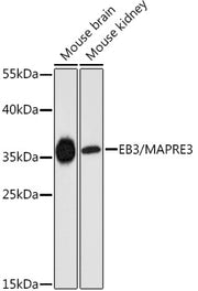 EB3/MAPRE3 Rabbit pAb