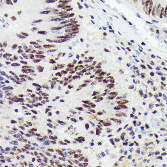 RNF40 Rabbit mAb