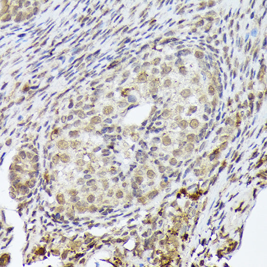 PSMD14 Rabbit mAb