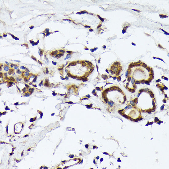 PSMD14 Rabbit mAb