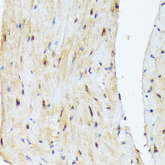 PSMD14 Rabbit mAb