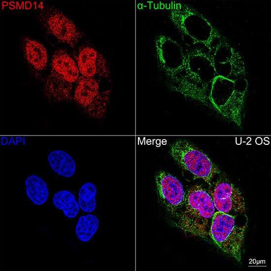 PSMD14 Rabbit mAb