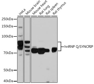 hnRNP Q/SYNCRIP Rabbit mAb