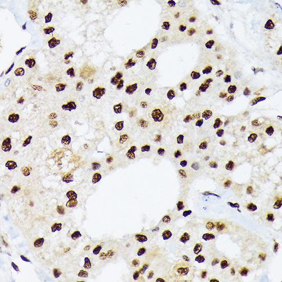 hnRNP Q/SYNCRIP Rabbit mAb