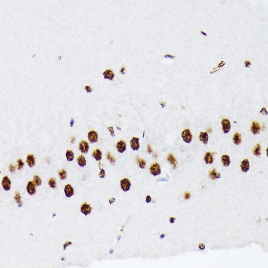 hnRNP Q/SYNCRIP Rabbit mAb